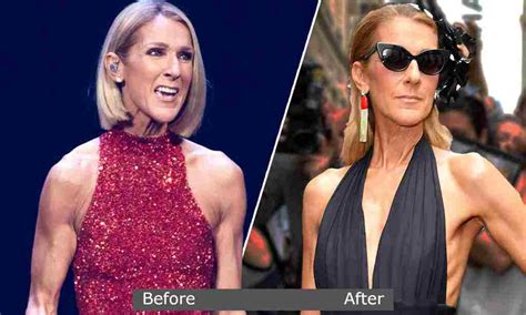 is Celine dion losing weight